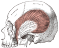 Le muscle temporal sans l'arcade zygomatique et sans le muscle masséter.