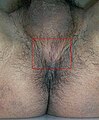 Male perineum highlighted in red square