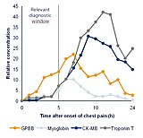 Comparison of cardiac marker in the first hours after chestpain onset and the relative concentration.