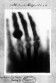 Bertha Röntgen's hand, one of the first x-ray images.