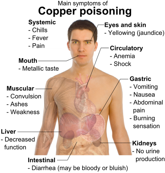 File:Main symptoms of copper poisoning.png