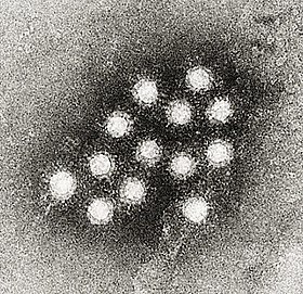 Hepatovirus