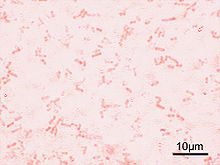 Shigella flexneri Gram.jpg