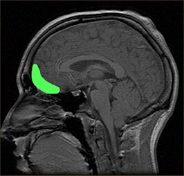 Op deze MR-scan is de cortex orbitofrontalis aangegeven in groen.