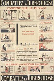 En fransk affisch från cirka 1910-talet (vänster) och en amerikansk affisch från 1920-talet (höger) som båda syftar till att försöka stoppa spridningen av tuberkulos.