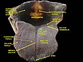 Floor of mouth. Deep dissection. Anterior view.