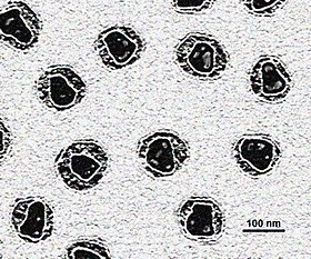 Eletromicrografia de partículas virais de HIV