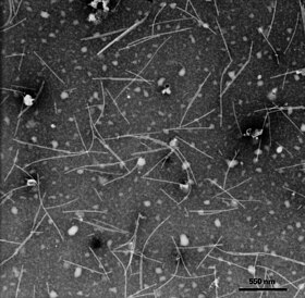 Micrografia eletrônica de vírions filamentosos do Narcissus mosaic virus (NMV)