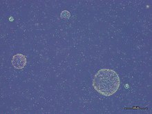 Phaeocystis globosa colonies.