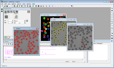 GUI of a previous version of Aphelion (version 3.2j) with multiple detached windows per image (Multiple document interface).