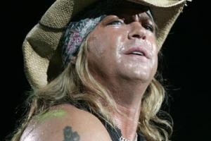 Bret Michaels in ICU! Poison singer is in critical condition!