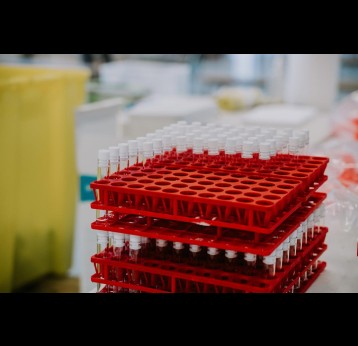 A rack of test tubes in a lab. Credit: Mat Napo on Unsplash