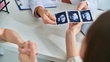 Krad sperm swoich studentw. Lekarz wpad przez przypadek