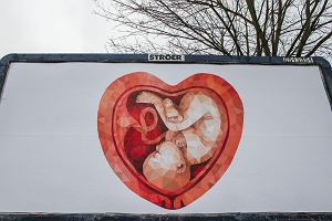 Billboard antyaborcyjny z wykorzystaniem pracy Jekateriny Gazkowej, Bydgoszcz