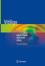 Vitiligo by Mauro Picardo