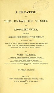 Cover of: A treatise on the enlarged tonsil and elongated uvula by James Yearsley, James Yearsley