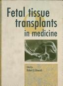 Cover of: Fetal tissue transplants in medicine