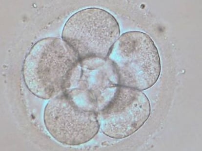 Embri&oacute;n humano en estado de 8 c&eacute;lulas ( 3 d&iacute;as de desarrollo embrionario in vitro)