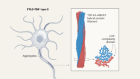 Hybrid protein filaments are a surprise twist in neurodegeneration