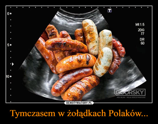 Tymczasem w żołądkach Polaków... –  0.5.10.BMI:1.52DG77DR60GOORSKYHOJ BLOG-HOJA RZECZYWISTOŚC