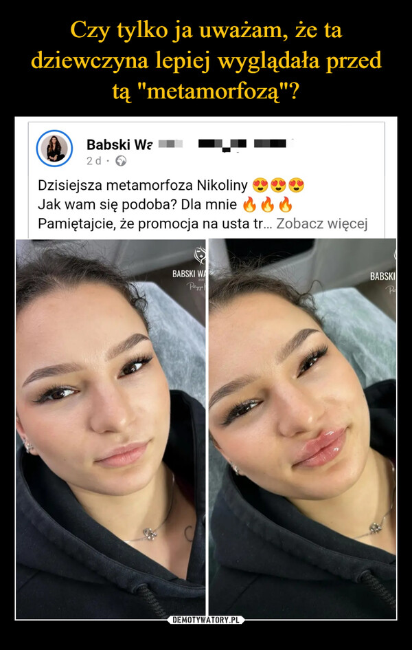  –  Babski Wa■■2d.Dzisiejsza metamorfoza Nikoliny +Jak wam się podoba? Dla mnie66Pamiętajcie, że promocja na usta tr... Zobacz więcejBABSKI WAPatrycja |BABSKIPat