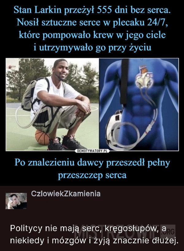 Przeżył 555 dni bez serca –  