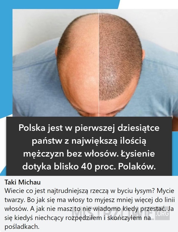 Włosy –  