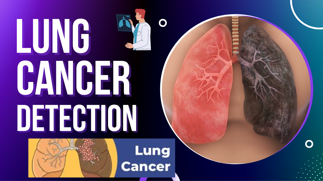 Lung-Cancer-Detection-Project